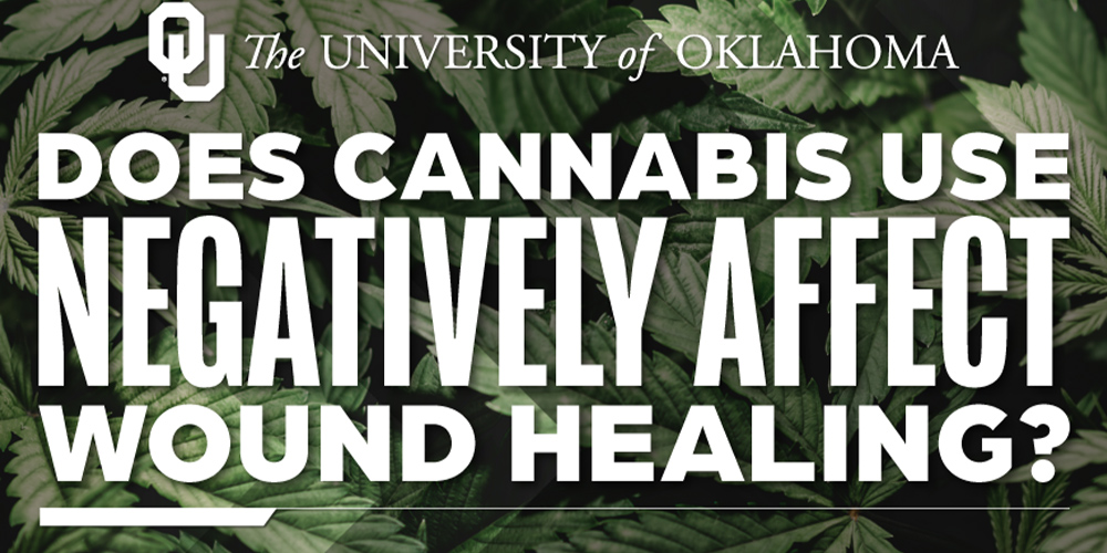 OU Researchers Study Effects of Cannabis on Facial Wound Healing After Surgery